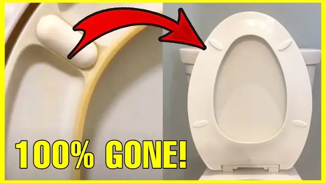 How To Remove Yellow Stain From Toilet Seat